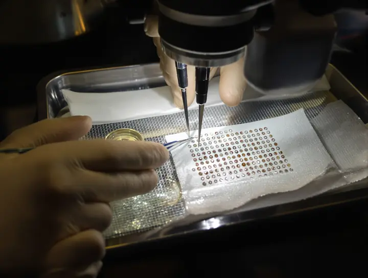 Technician sorting hair grafts under a microscope