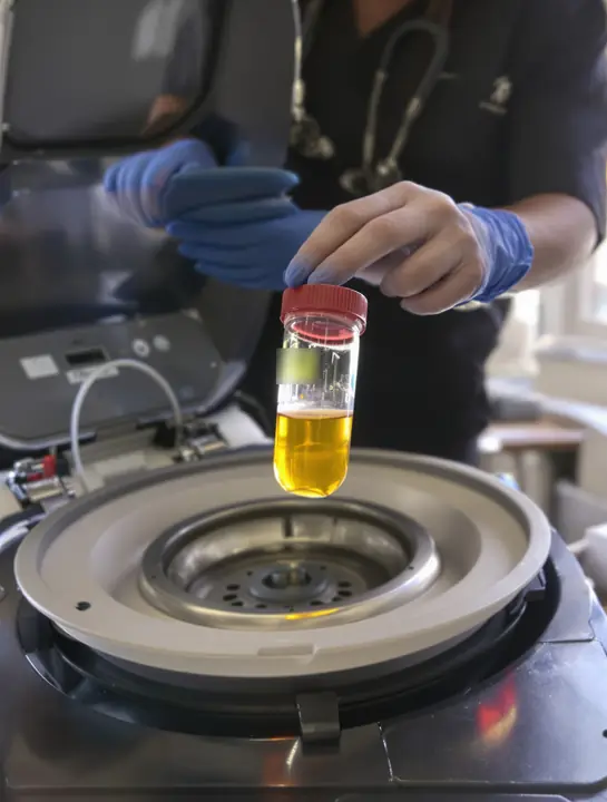 Nurse holding up separated plasma next to the centrifuge